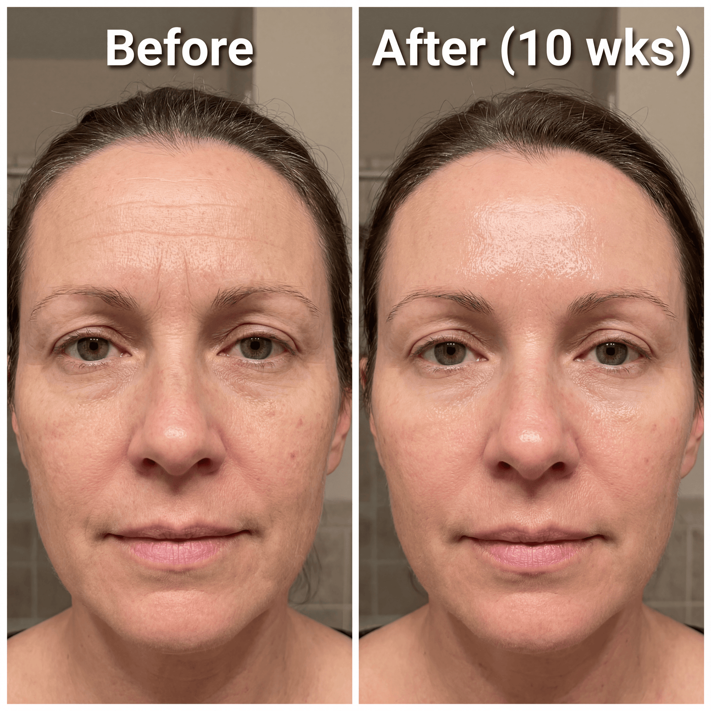 Novexa™ Scar & Wrinkle Stick Silicone Treatment for Face & Body