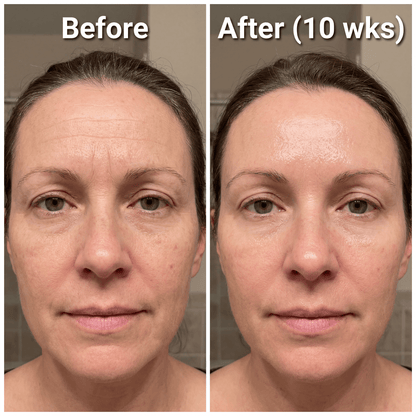 Novexa™ Scar & Wrinkle Stick Silicone Treatment for Face & Body