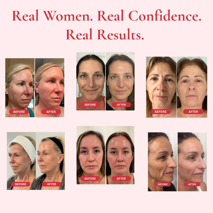 NOVEXA™ Time Reverse Cream (All-In-One)