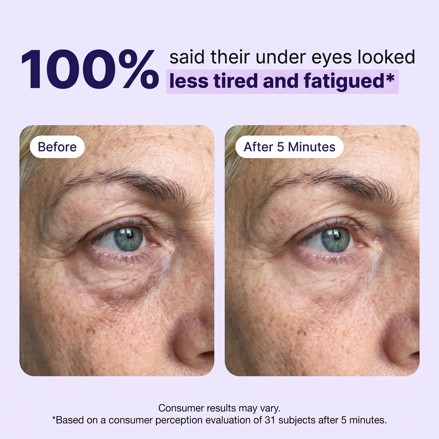 NOVEXA Instant Lift Eye Gel