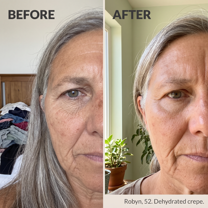 NOVEXA Occlusa™ Under-Eye Film