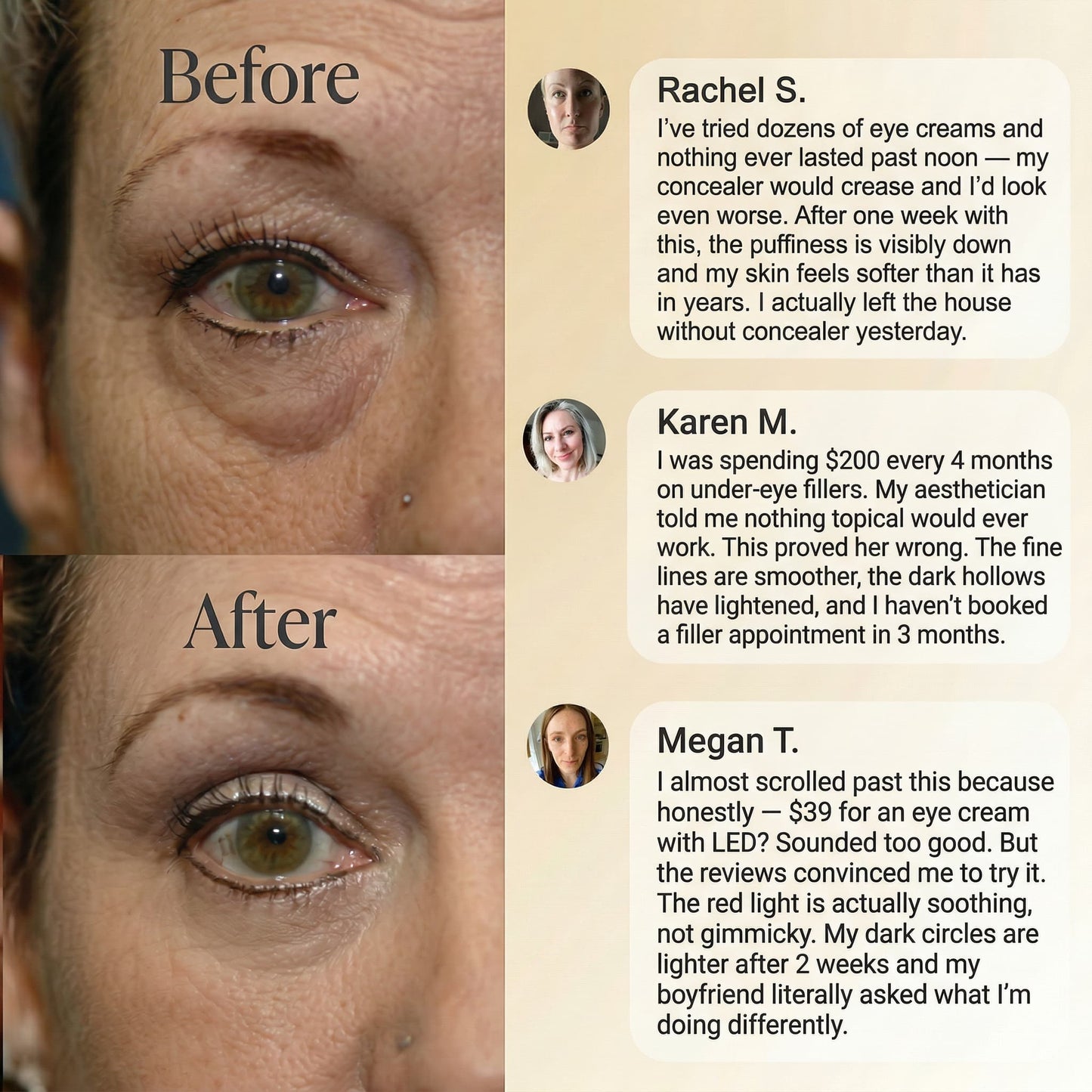 NOVEXA™ LumiLift Eye Therapy